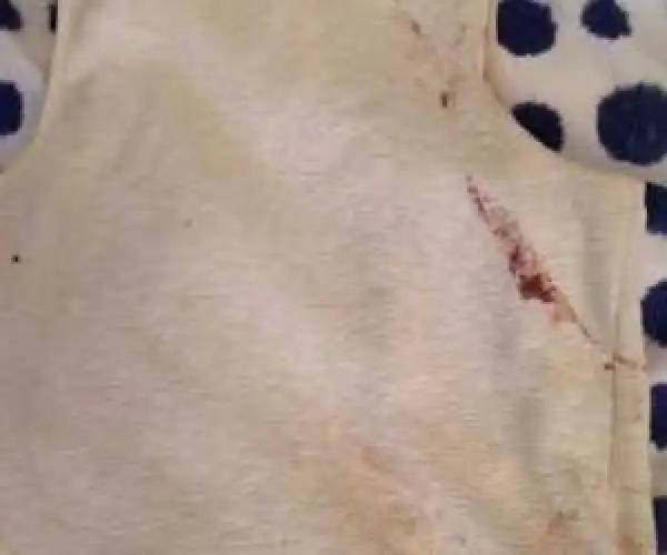 Paris Attack: Survived Woman Tells How She Pretends To Be Dead 